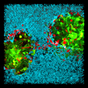 3D reconstruction of prostate cancer cells in collagen captured by 2-photon microscopy (Matthew Lakins)