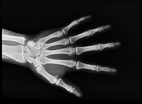 image of bones in hand