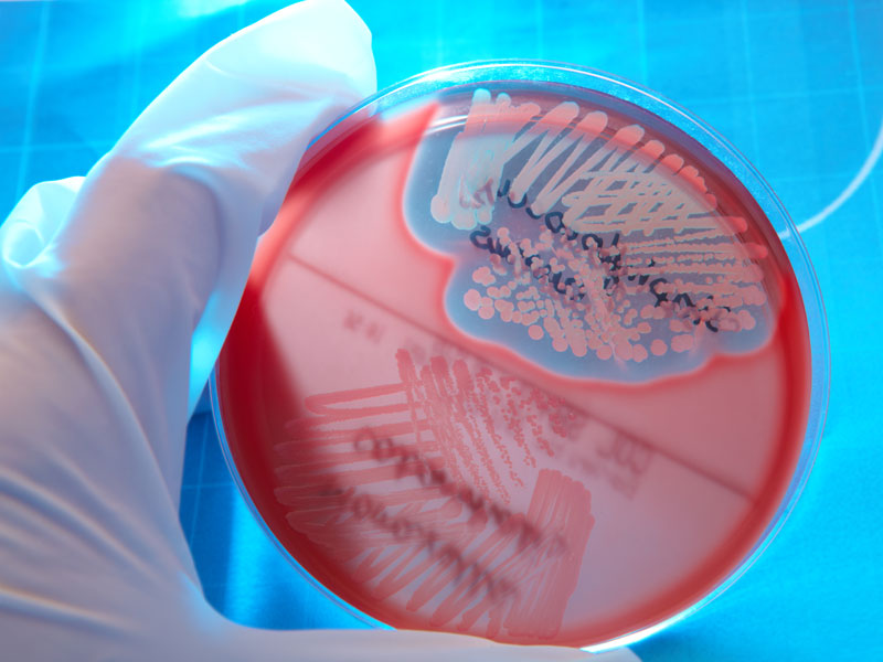 Hand in glove holding Petri plate with bacteria Staphylococcus Aureus, Moraxella Catarrhalis 