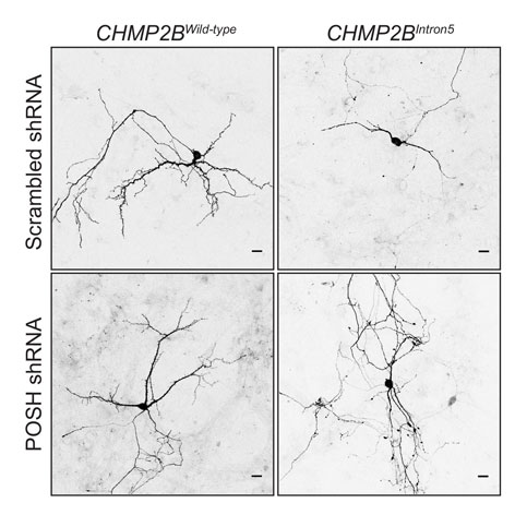 POSH mediates dendritic collapse in the presence of mutant CHMP2B. In rat primary neurons expressing wildtype CHMP2B or mutant CHMP2B (CHMP2BIntron5), dendritic collapse is observed when the mutant form of the protein is present. When cultures are treated with shRNA to knockdown the pro-apoptotic protein POSH, the CHMP2BIntron5 mediated dendritic collapse is rescued.