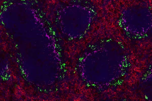 Gulab Rani's image of macrophage populations in normal adult wild type mouse spleen