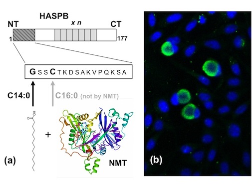 Figure 2 (a) Main routes of research in HASP-protein related research:HASP proteins as targets for fatty acid acetylation by NMT enzyme. (b) Microscope snapshot of Chlamydia trachomatis attacking human cells (courtesy of William Paes).