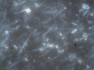 Diatomite seen under x1000 magnification