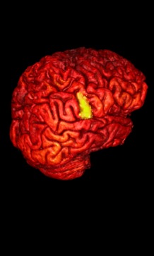 3d Brain with activation shown