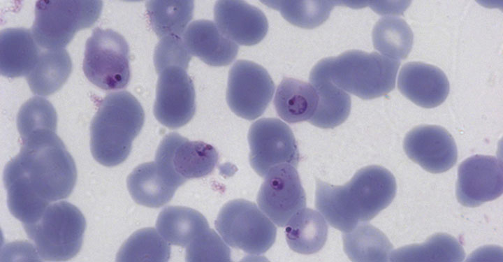 Malaria parasite infected human cells (credit: Imaging and Cytometry lab (Karen Hogg) in the Biology Technology Facility)